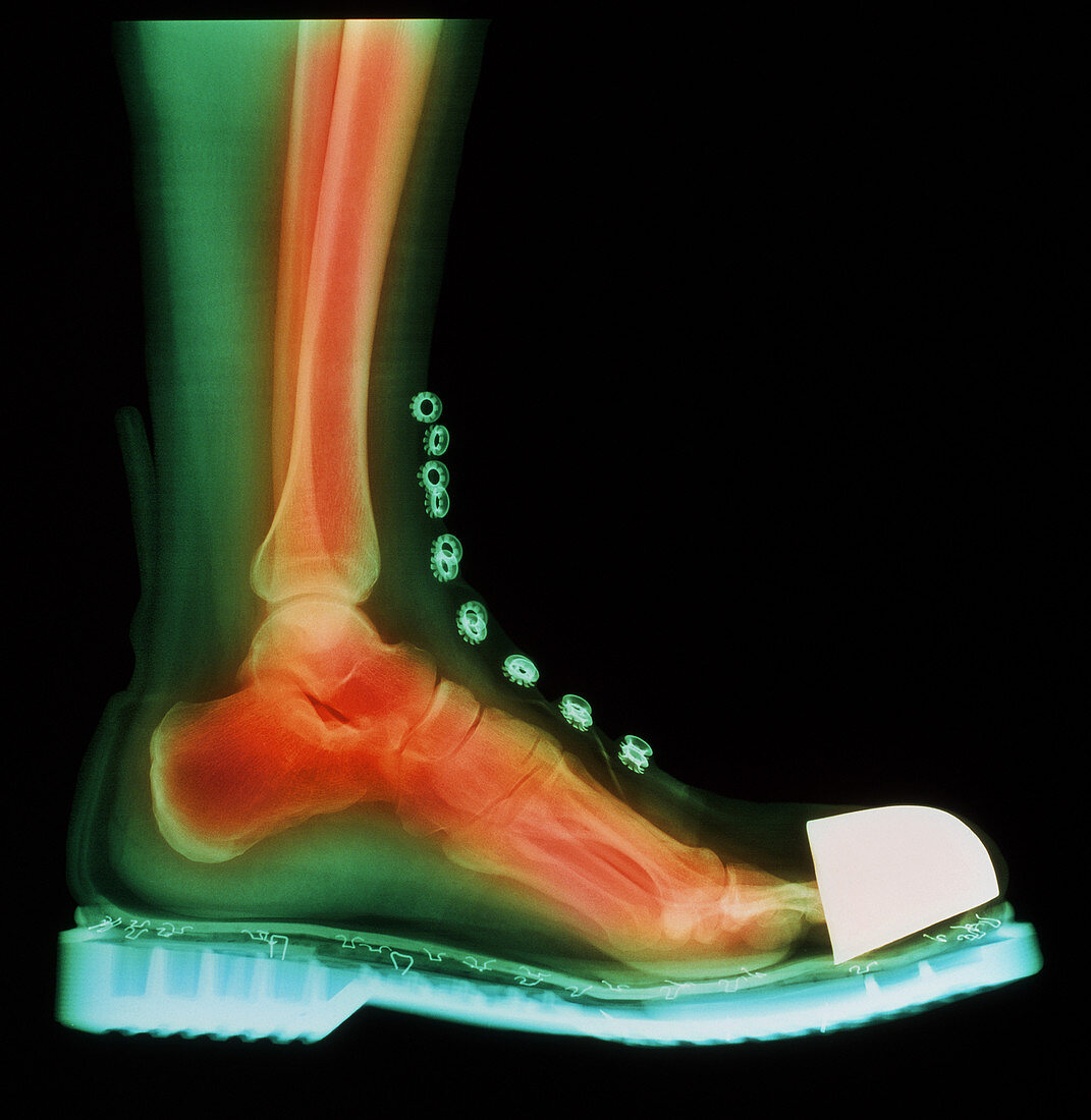 Coloured X-ray of man's foot in a Doc Marten boot