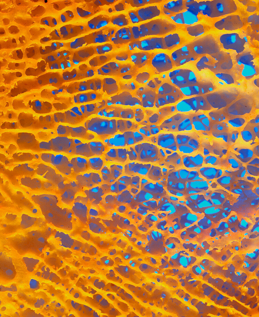 Normal cancellous spongy bone from upper