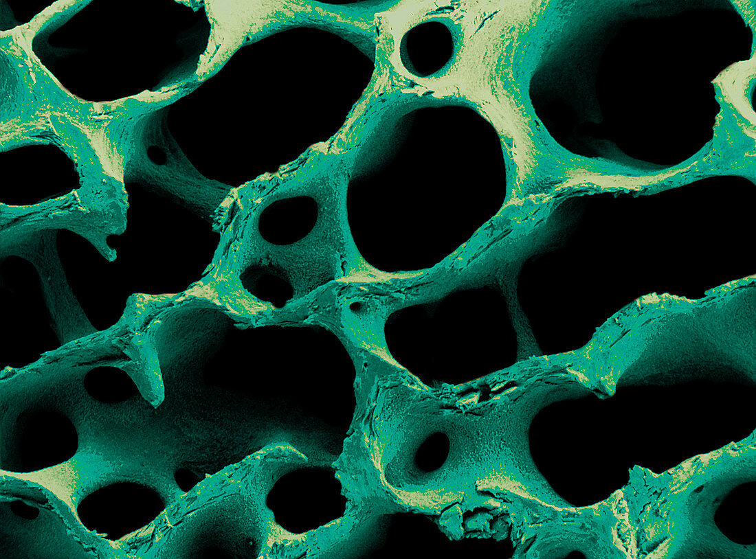 Coloured SEM of human spongy bone