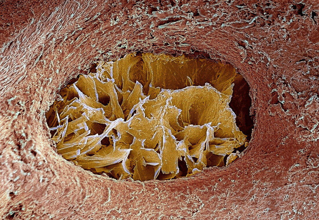 Bone lacuna,SEM