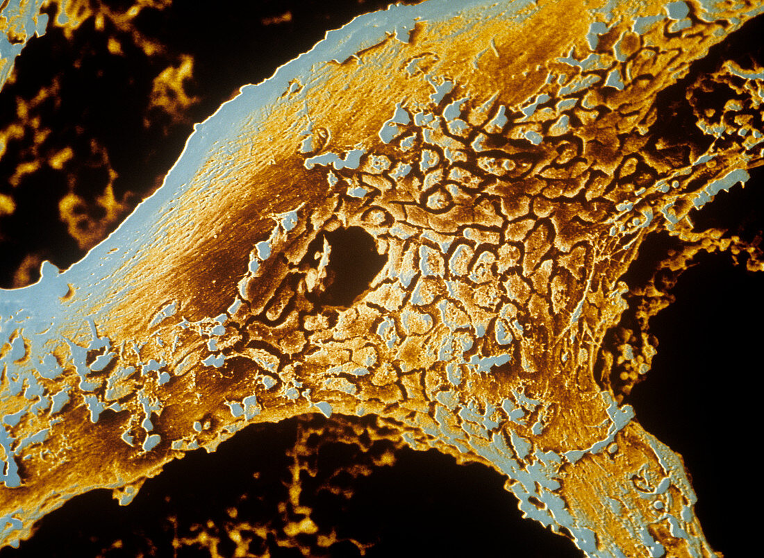 Osteoblast bone cells,coloured SEM