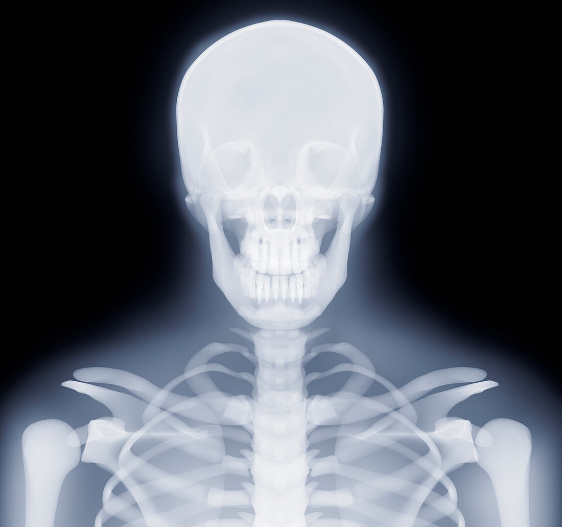 Head and shoulders,X-ray artwork