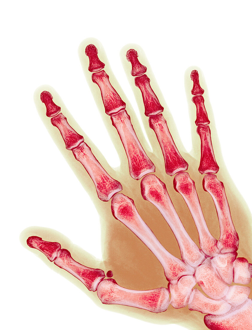 Healthy adult hand,X-ray