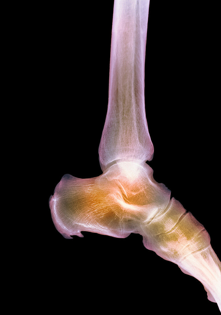 Healthy ankle,X-ray