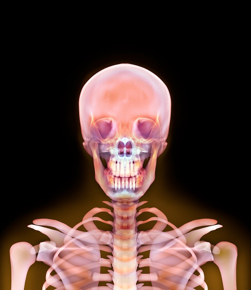 Head and shoulders,X-ray artwork