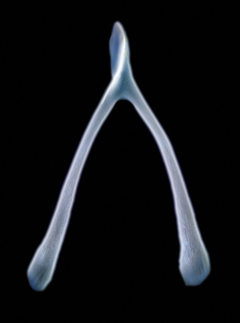 Wishbone X-ray