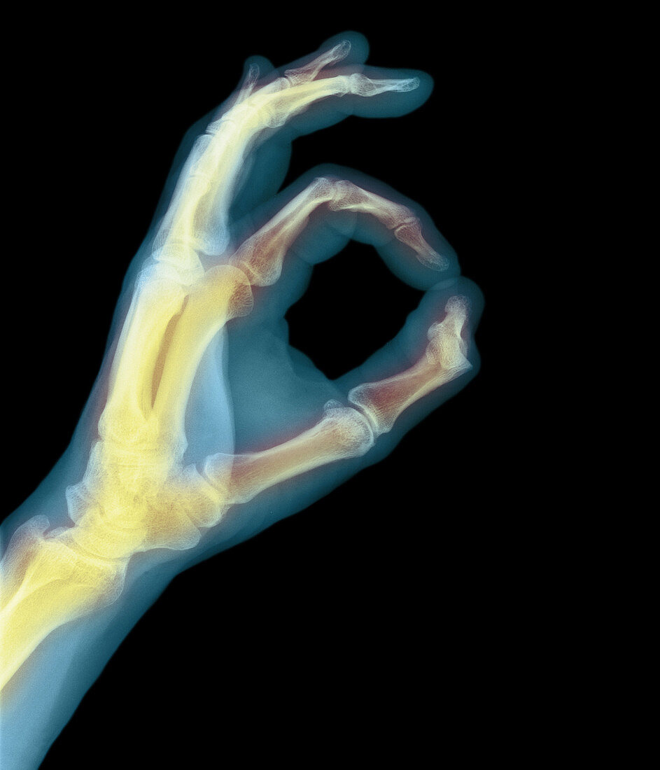 Coloured X-ray of a hand with fingers forming O