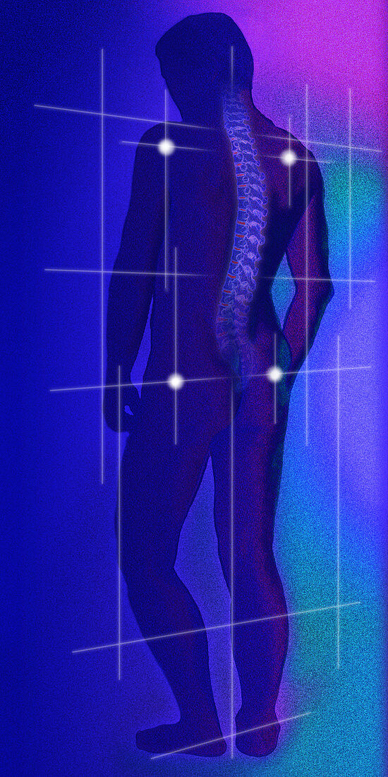 Computer illustratoion of a healthy human spine
