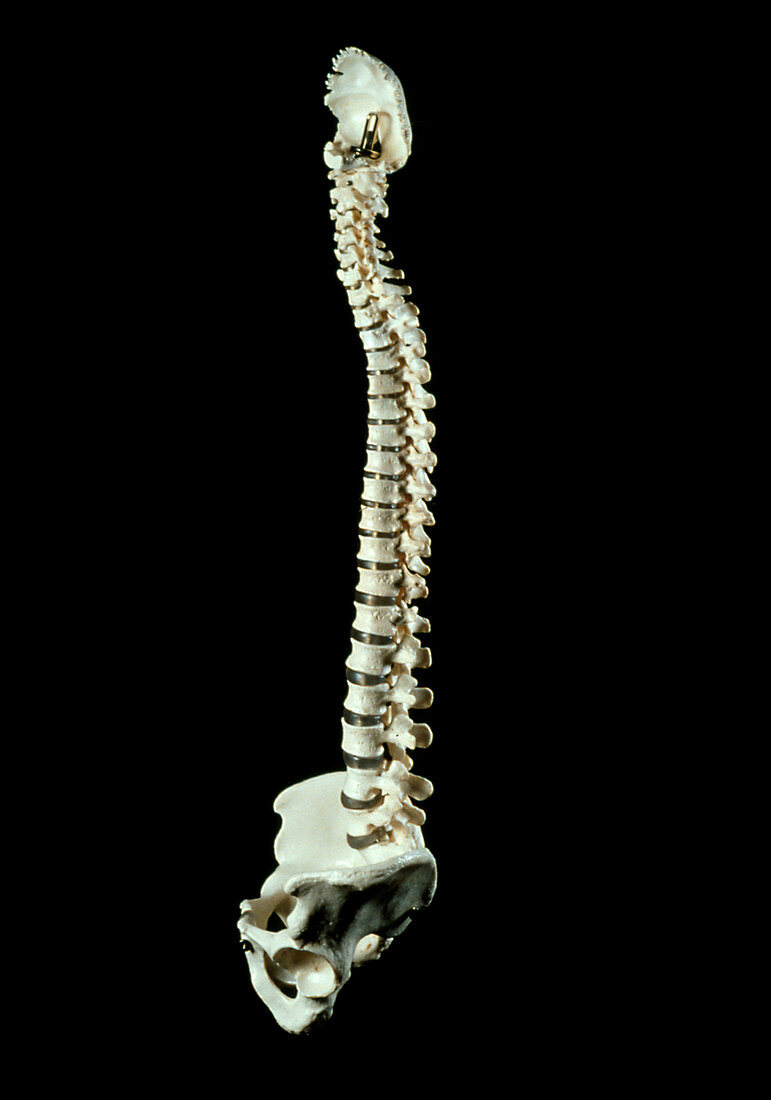 Model of a normal human spine seen from the side