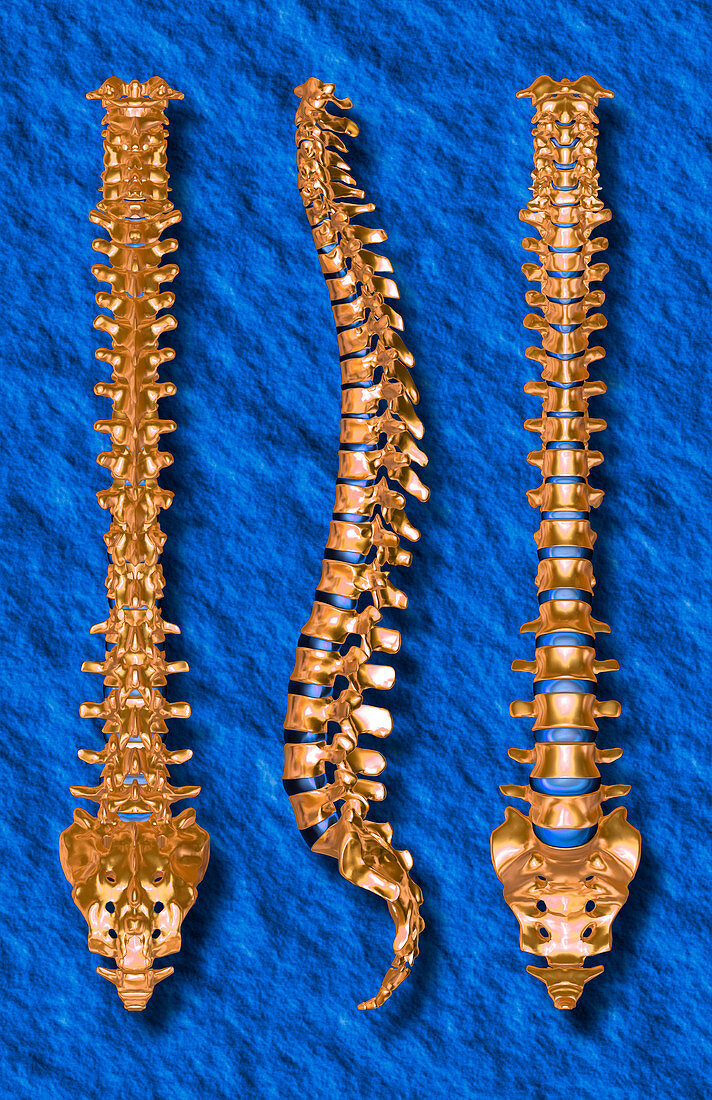 Computer artwork of three views of a human spine