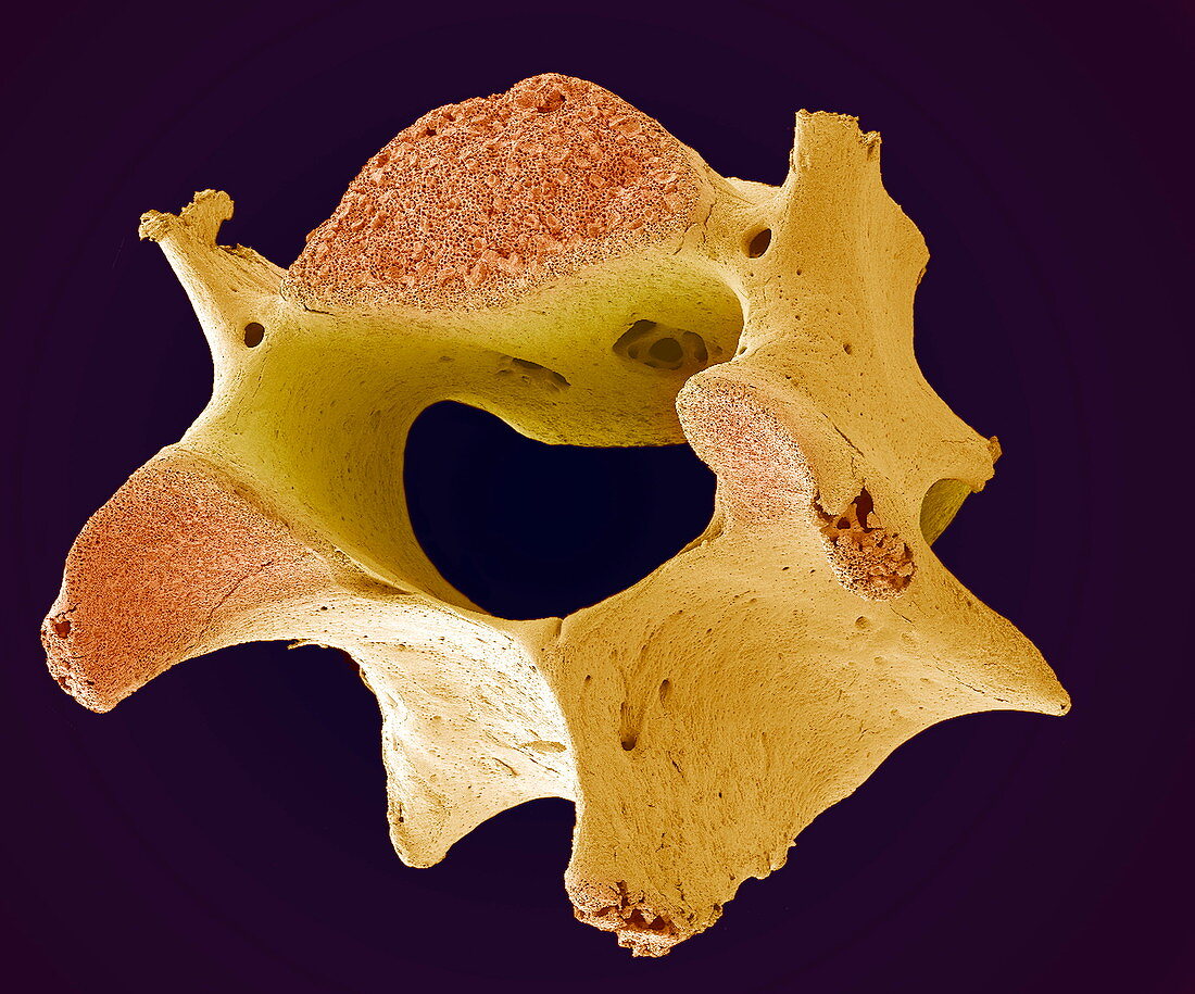 Vertebra,SEM