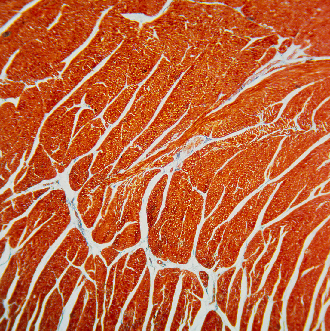 LM of cross section of heart muscle