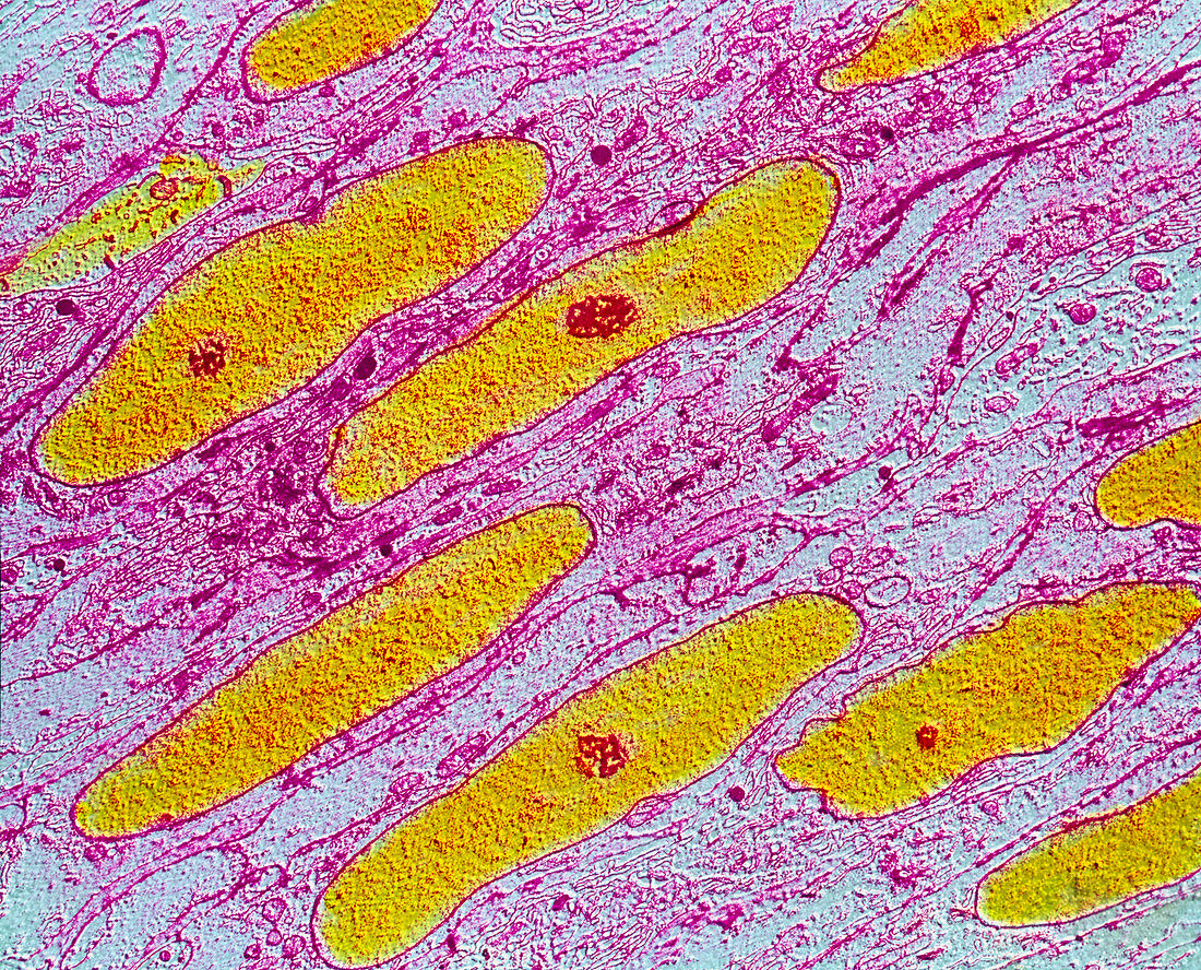Colour TEM of smooth muscle from uterus wall