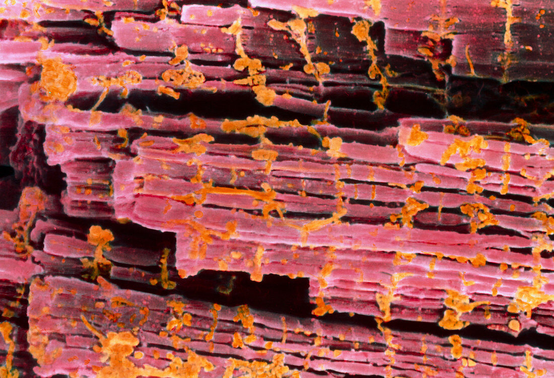 Coloured SEM of human striated muscle