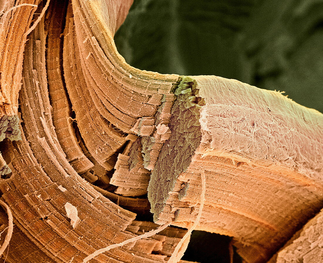 Muscle fibre,SEM