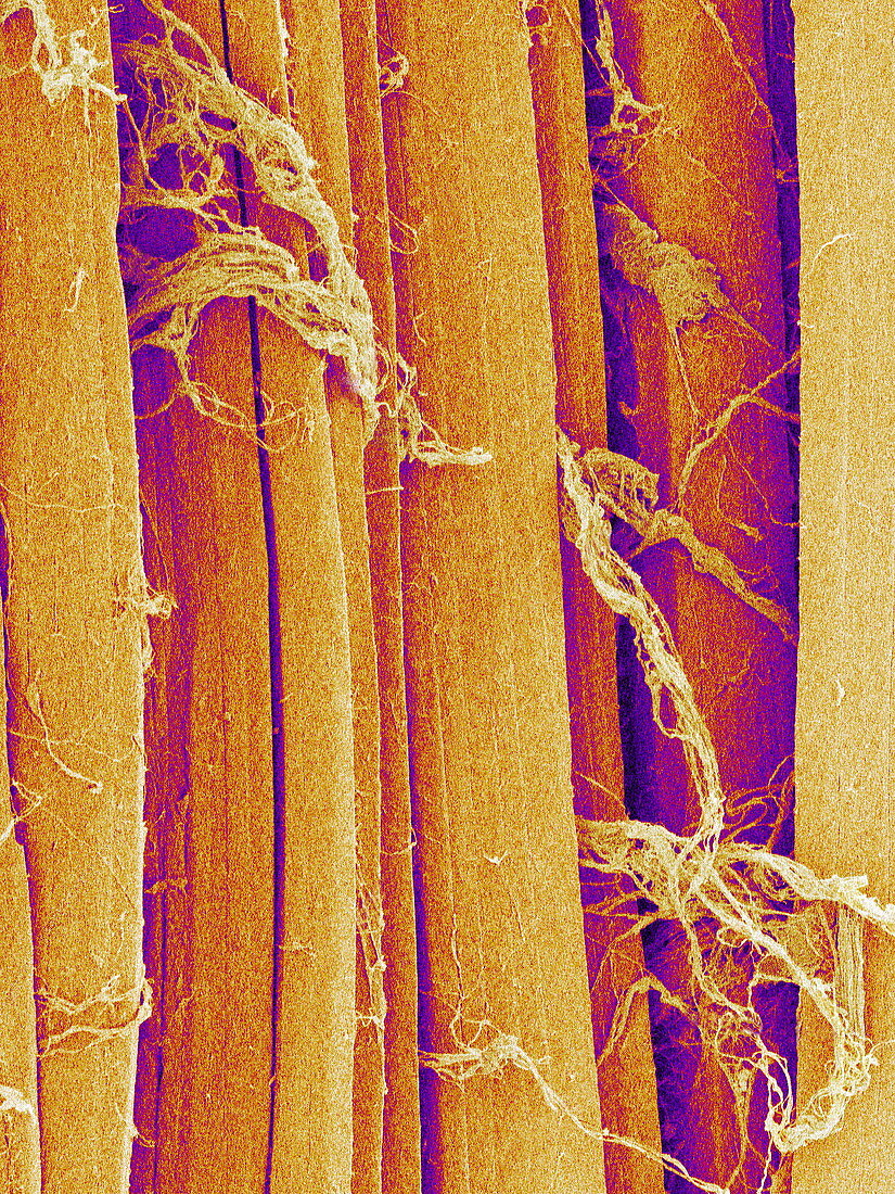 Skeletal muscle fibre