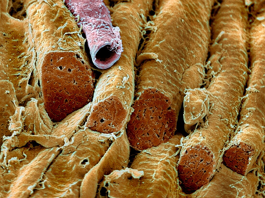Smooth muscle,SEM