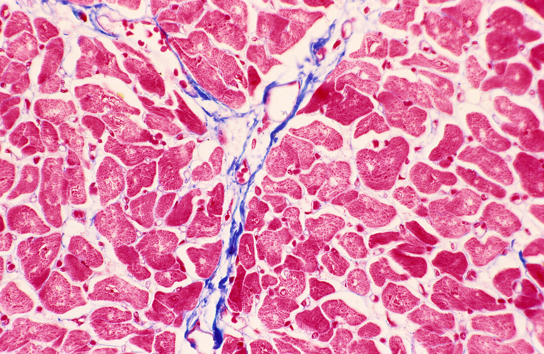 Heart muscle,light micrograph