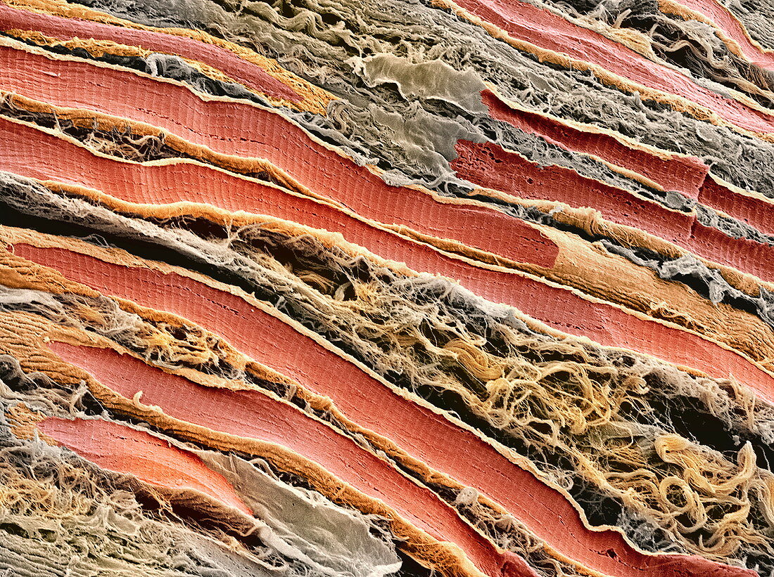Skeletal muscle fibres,SEM