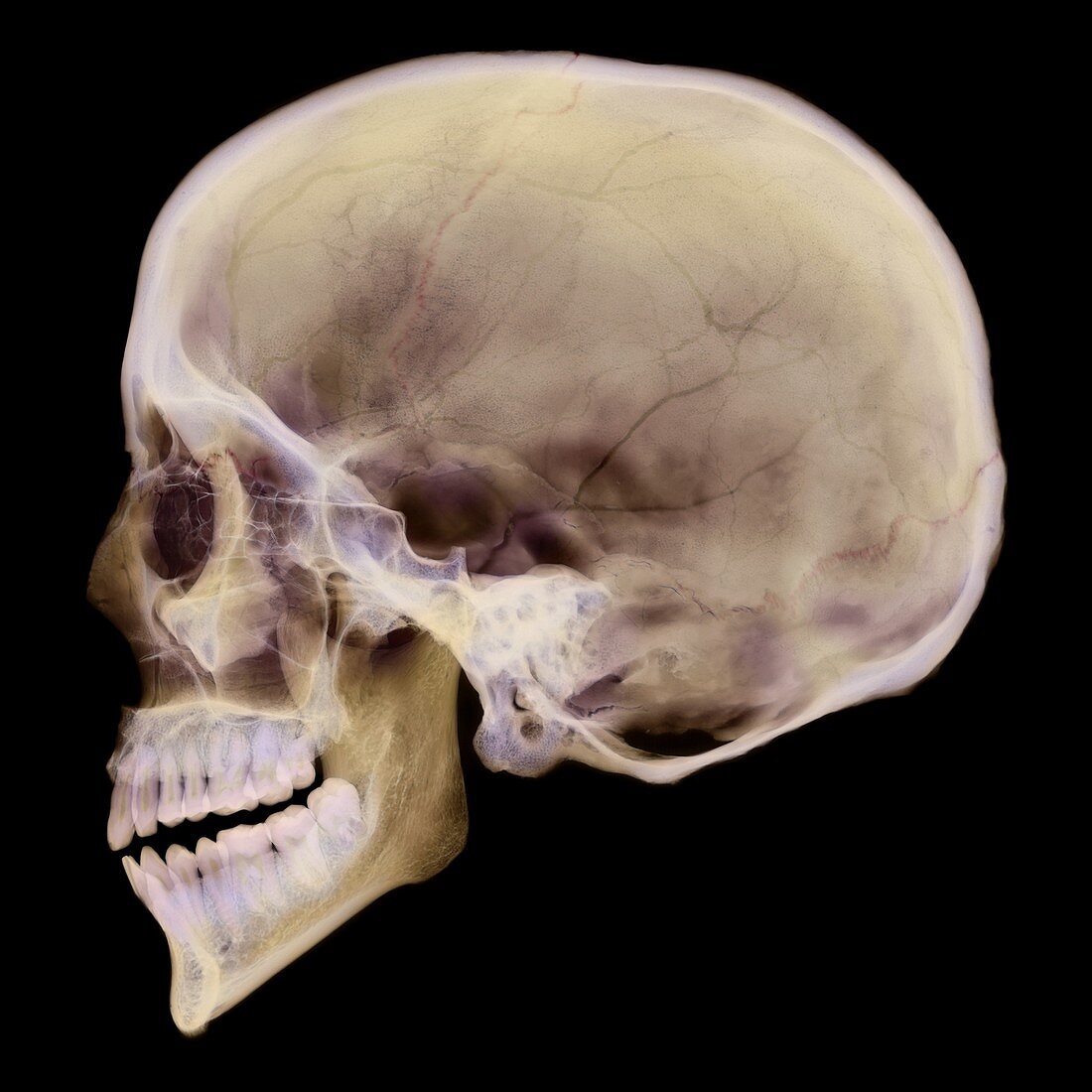 Human skull,X-ray