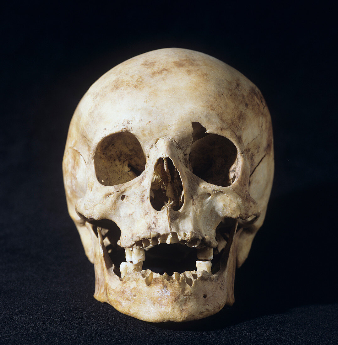 Skull of modern human