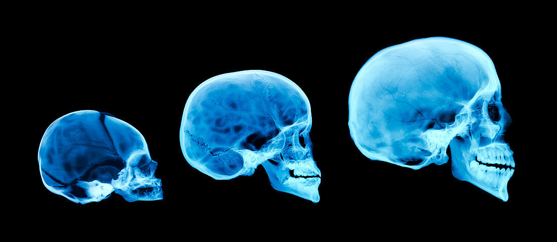 Human skull development