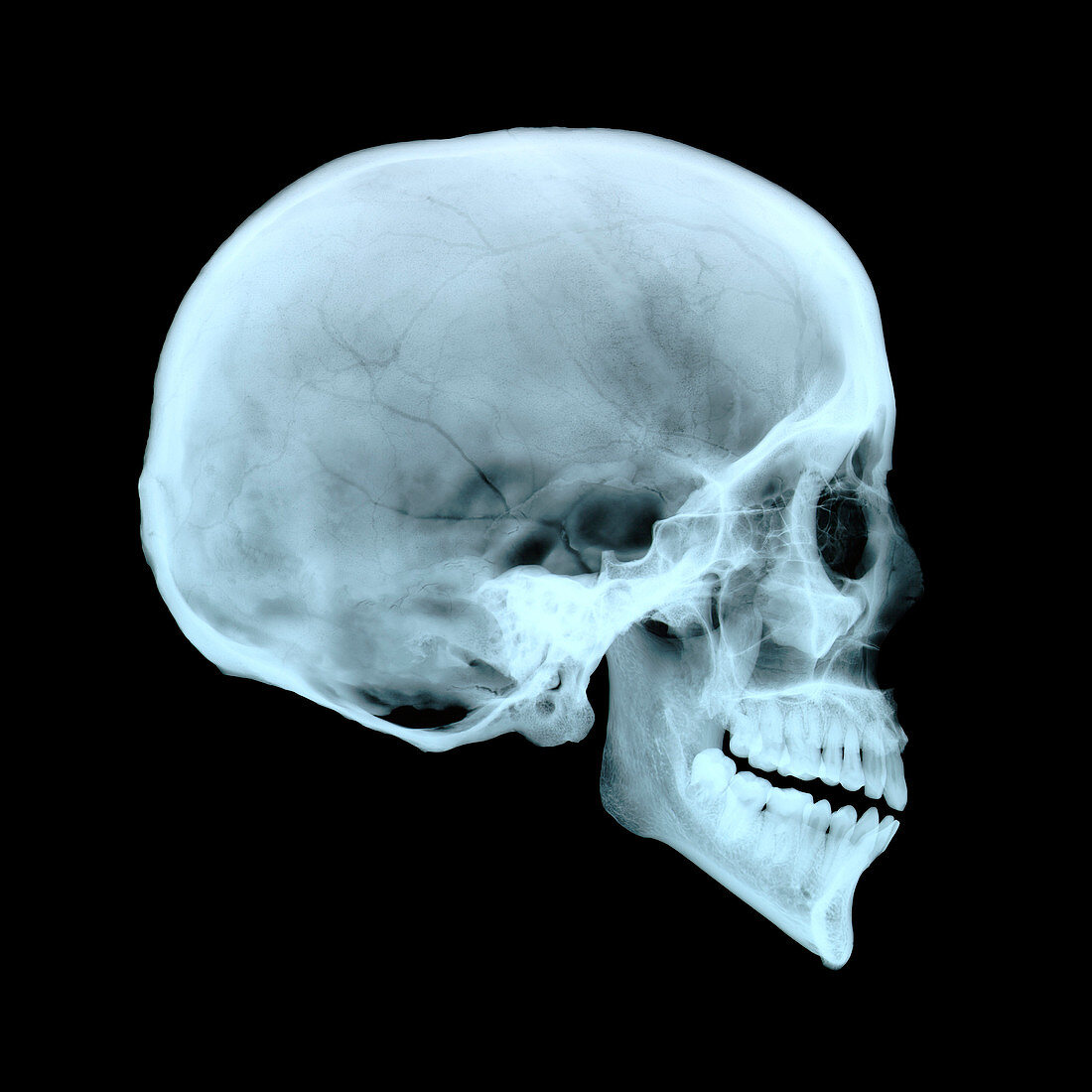 Adult human skull