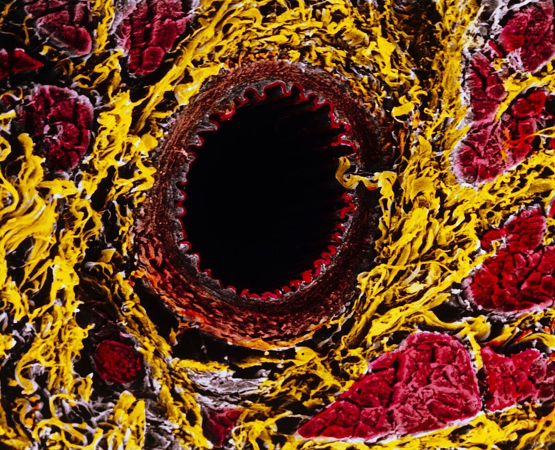Coloured SEM of an artery in tongue tissue