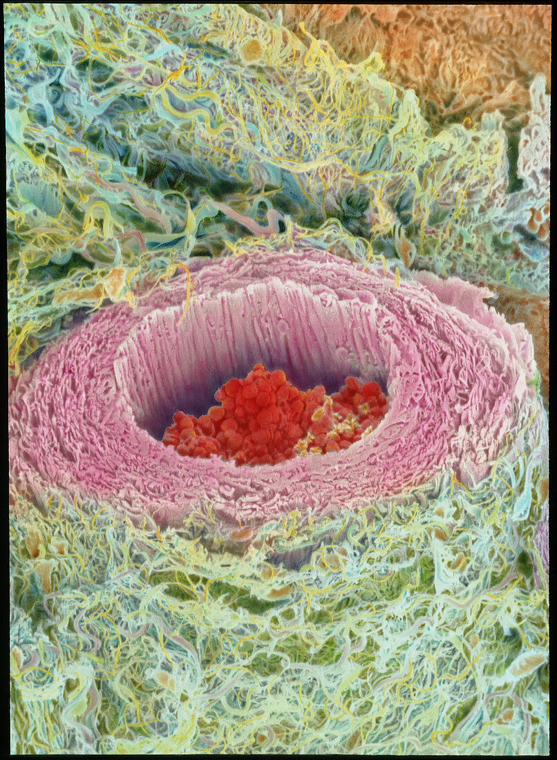 Coloured SEM of section through a human arteriole