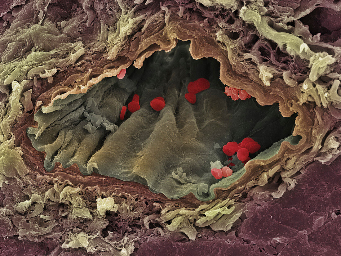 Artery SEM