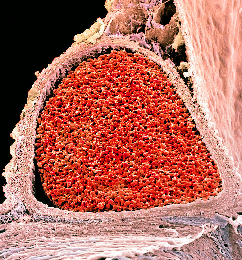 Blood-filled foetal aorta,SEM