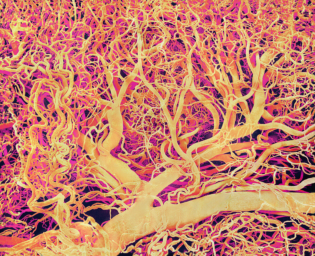 Blood vessels,SEM