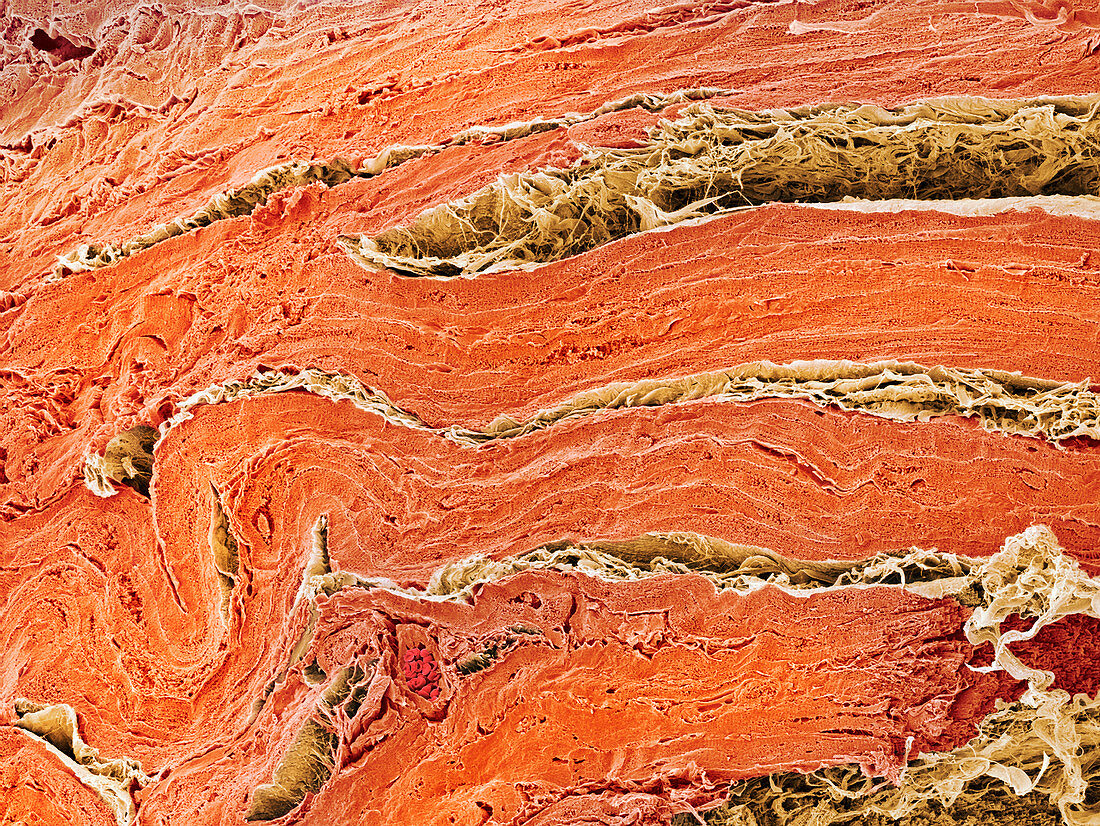 Cardiac muscle,SEM