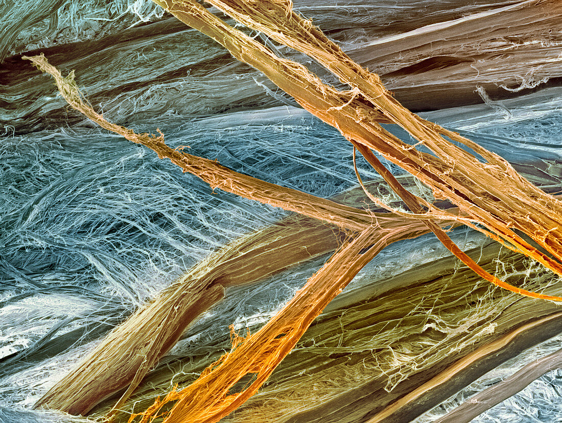 Tendon fibres,SEM