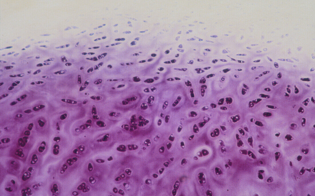 Light micrograph of costal cartilage from a rib