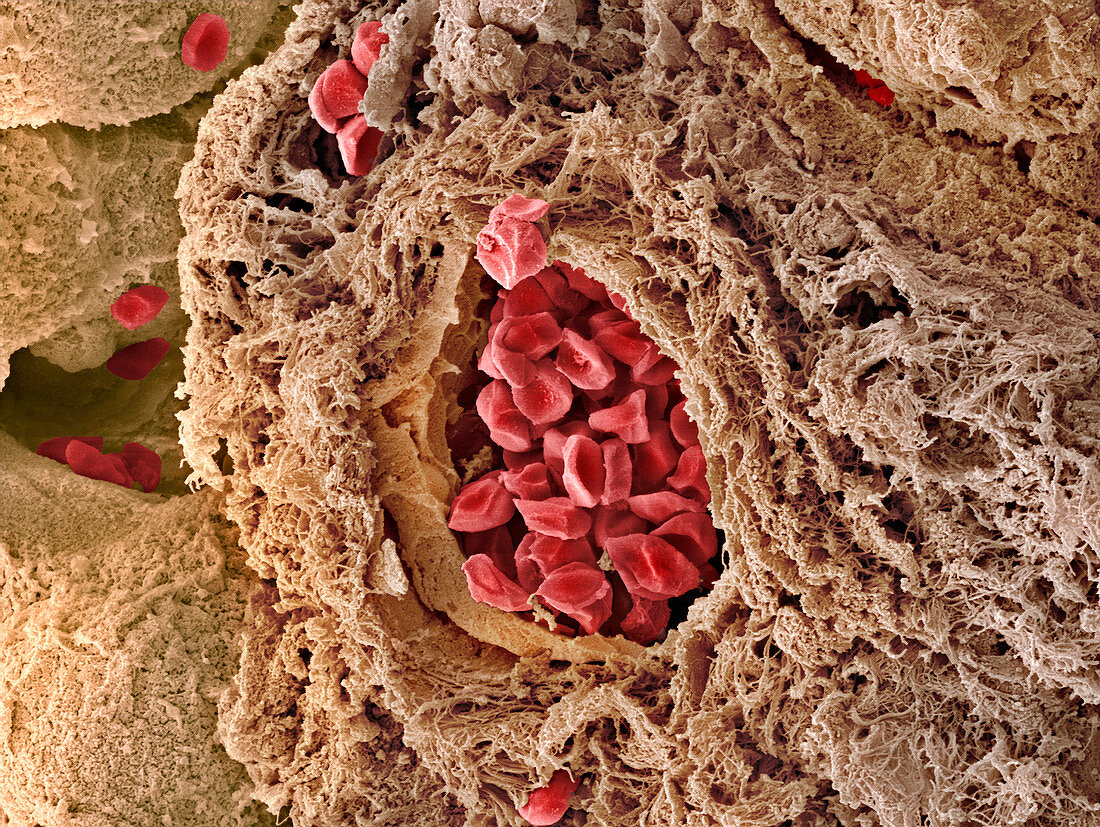 Placental blood vessel,SEM