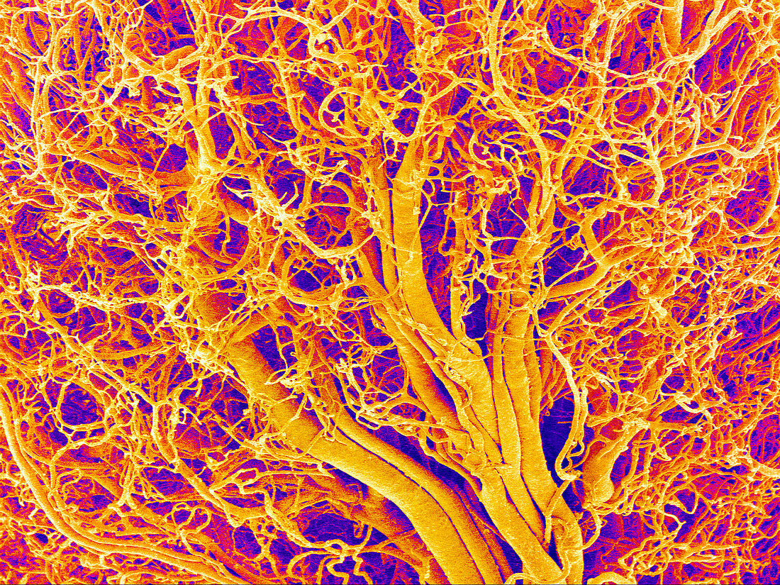 blood-vessels-of-a-lymph-node-sem-bild-kaufen-11868853-science