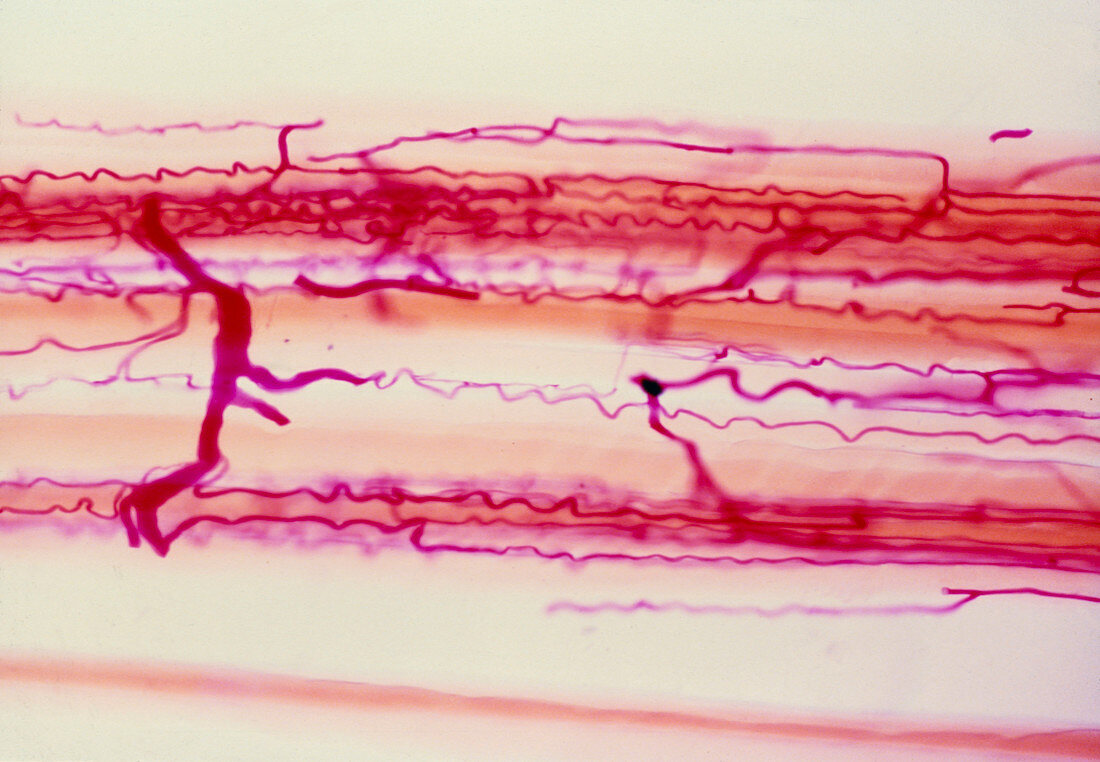 LM of capillary blood supply in skeletal muscle