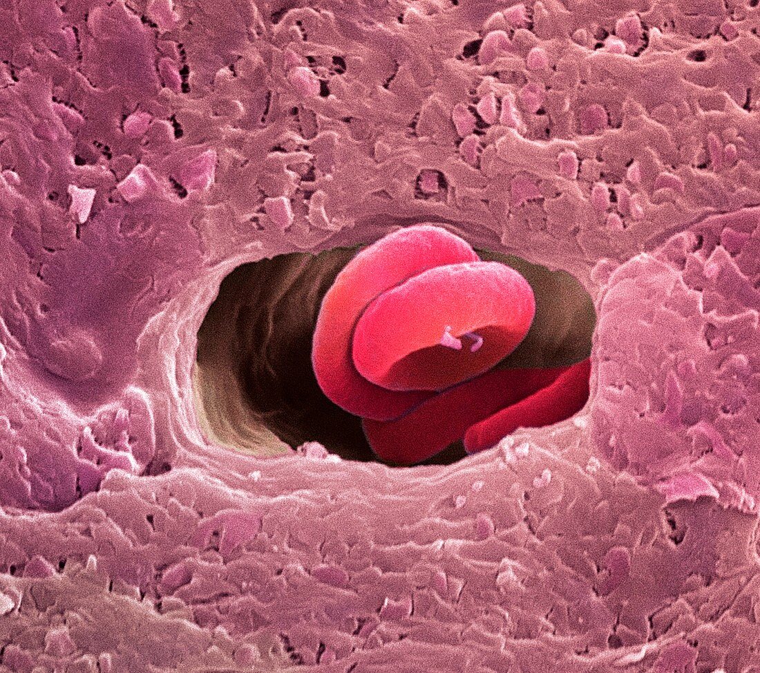 Coronary capillary,SEM