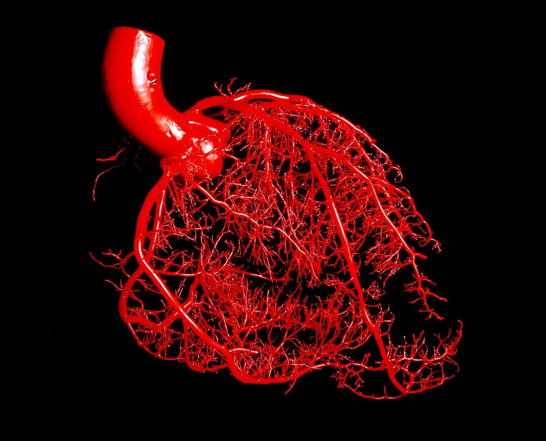 Resin cast of the coronary arteries of the heart