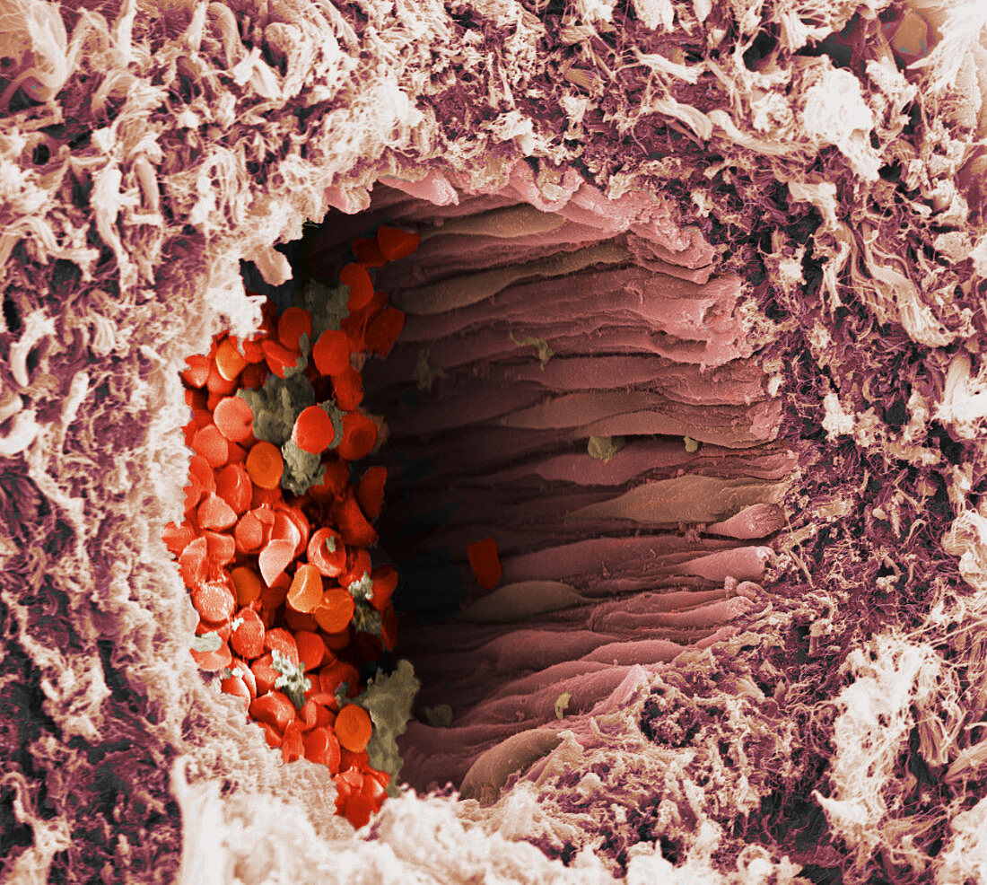 Arteriole and red blood cells,SEM