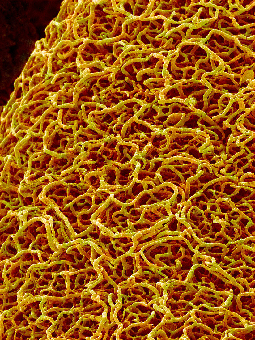 Blood vessels from the colon,SEM