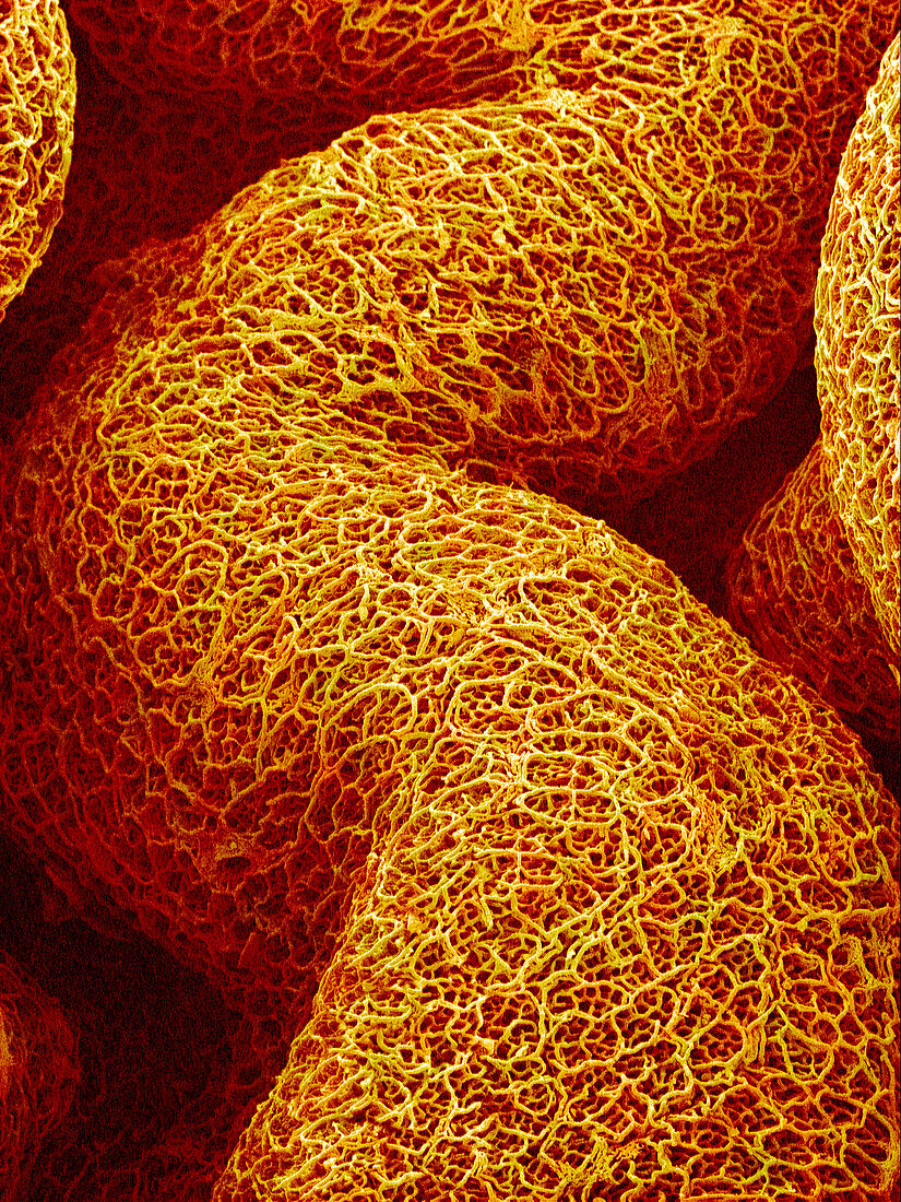 Blood vessels in the colon,SEM