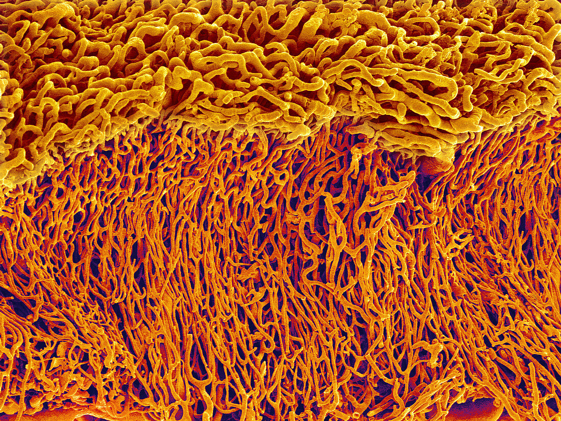 Blood vessels in the stomach wall,SEM