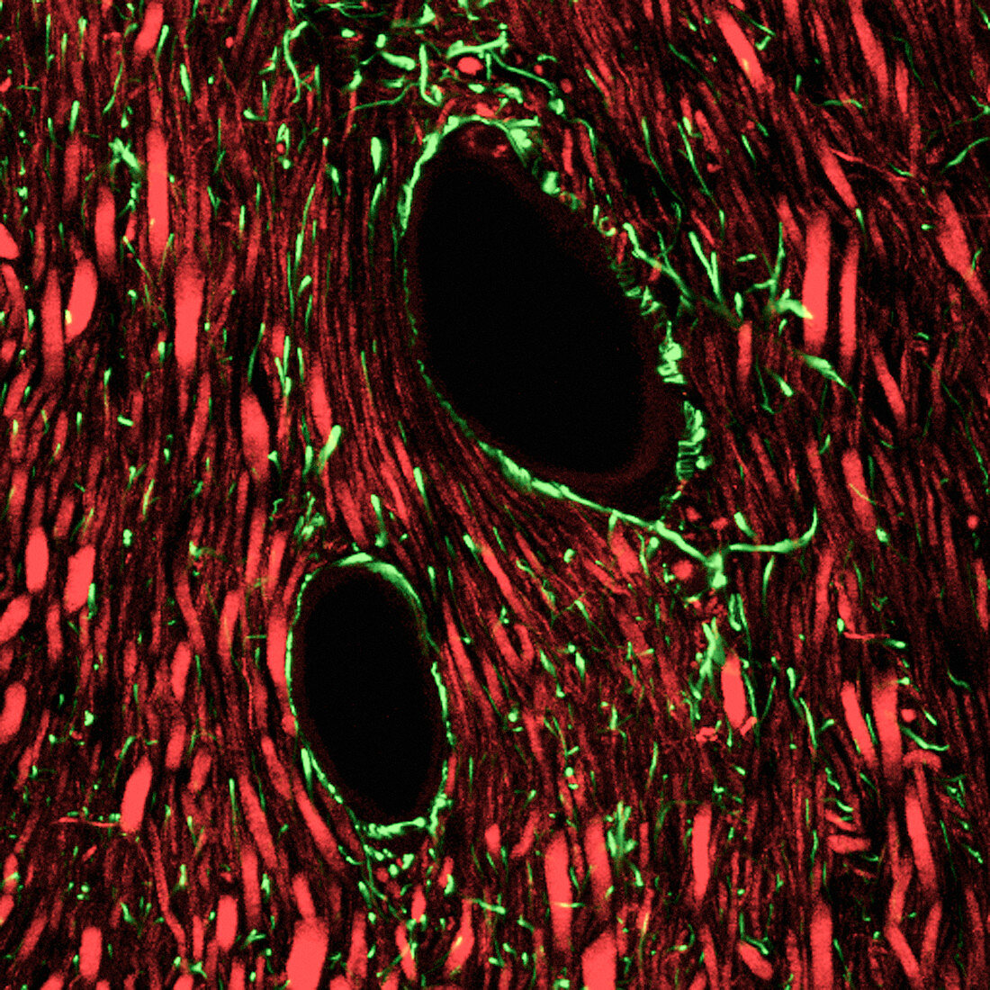 Brain blood vessels,light micrograph