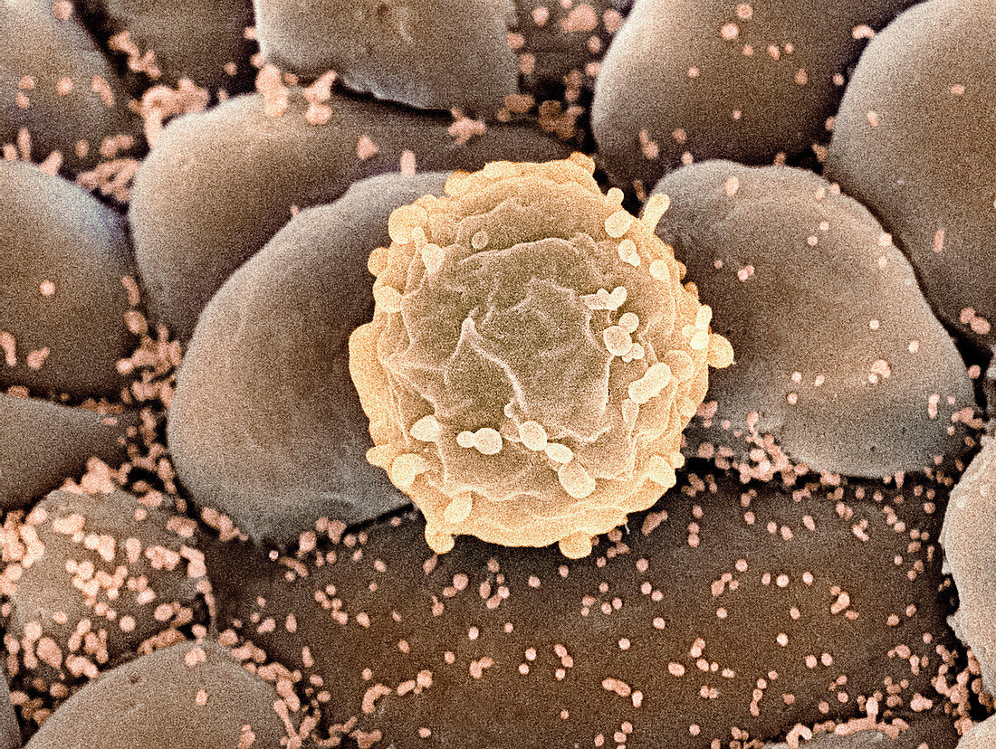 Foetal blood stem cell,SEM