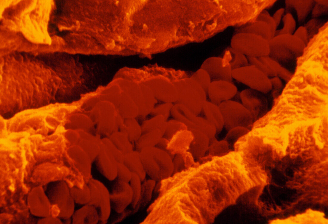 SEM of red blood cells in a blood capillary