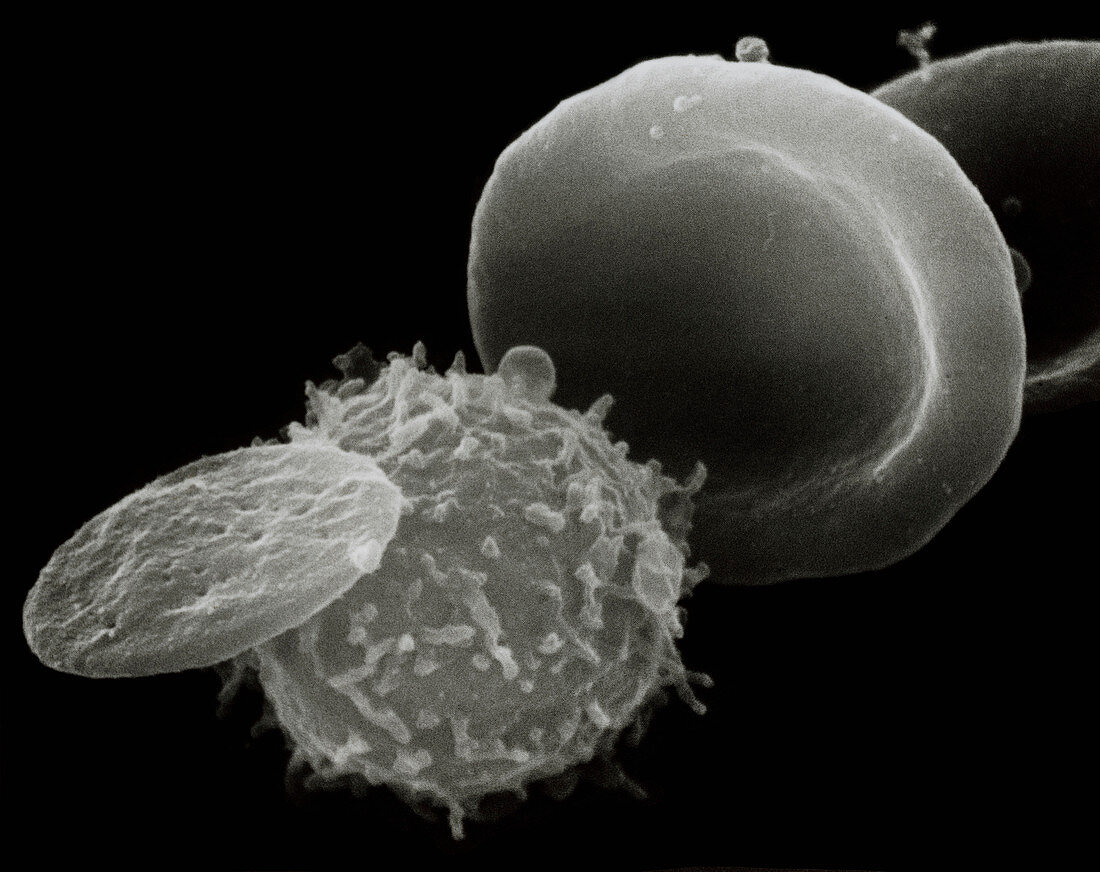 SEM of three types of cell found in human blood