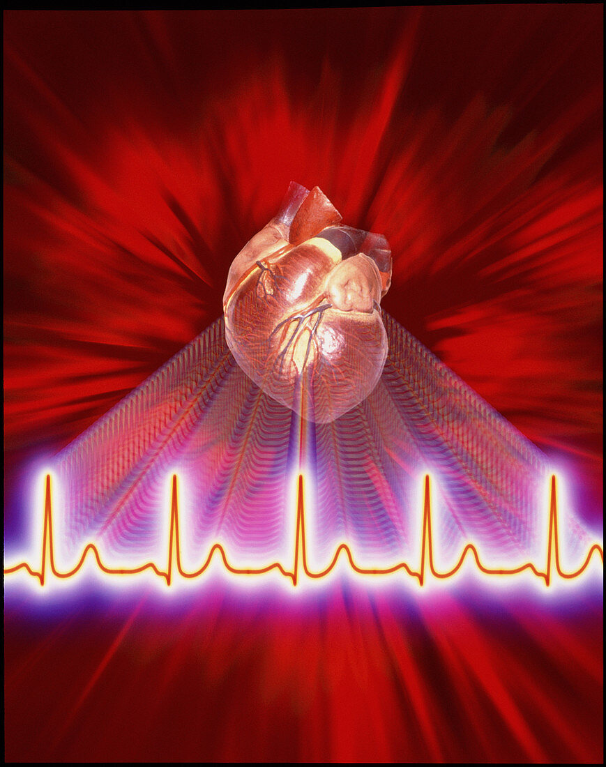Artwork of an ECG heart trace and a healthy heart