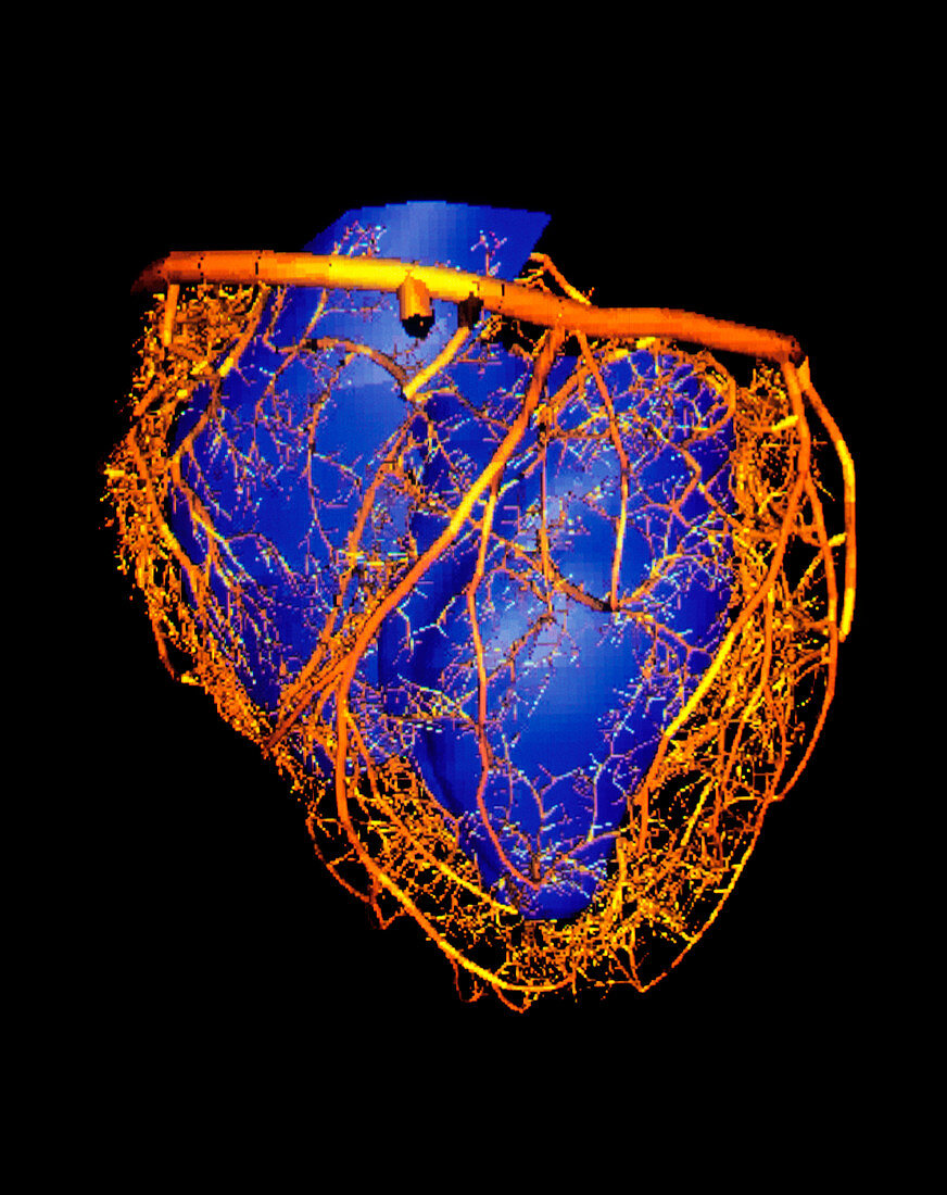 Computer simulation of a single heartbeat